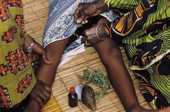 Fotografie ženské obřízky v Africe