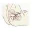 Fotografie zobrazující masáž prostaty