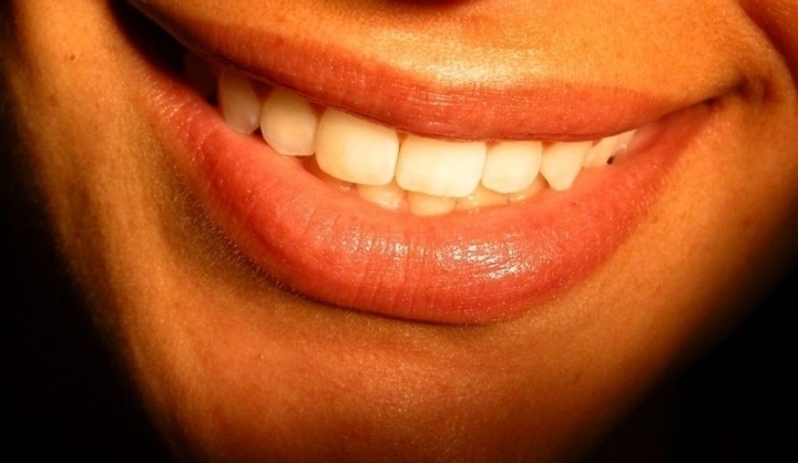 Fotografie zobrazující zářivý úsměv se zdravými zuby